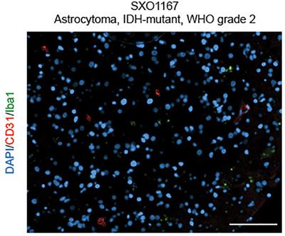 Preclinical modeling of lower-grade gliomas